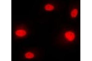 Immunofluorescent analysis of hnRNP M staining in MCF7 cells. (HNRNPM antibody  (N-Term))