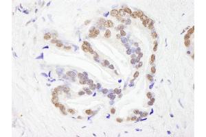 Immunohistochemistry (IHC) image for anti-RNA Binding Motif Protein 26 (RBM26) (AA 200-250) antibody (ABIN7448763) (RBM26 antibody  (AA 200-250))