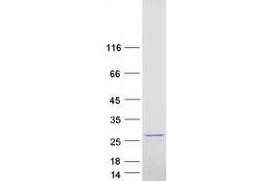 Western Blotting (WB) image for RAP1B, Member of RAS Oncogene Family (RAP1B) (Transcript Variant 2) protein (Myc-DYKDDDDK Tag) (ABIN2730473)