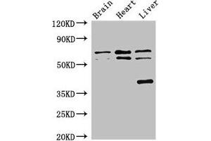 Western Blot Positive WB detected in: Mouse brain tissue, Rat heart tissue, Rat liver tissue All lanes: TRAF3IP3 antibody at 2. (TRAF3IP3 antibody  (AA 74-185))