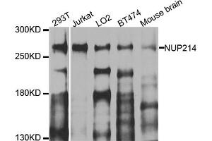 Western blot analysis of extracts of various cell lines, using NUP214 antibody (ABIN5974670) at 1/1000 dilution. (NUP214 antibody)