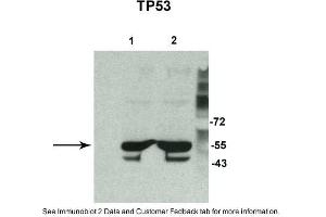 Sample Type: 1. (p53 antibody  (N-Term))