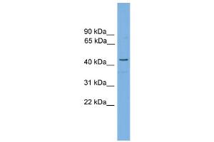 WB Suggested Anti-RDH16  Antibody Titration: 0. (RDH16 antibody  (Middle Region))