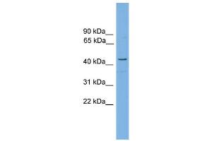 WB Suggested Anti-RDH16  Antibody Titration: 0.