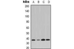 Western blot analysis of IKB alpha (pY42) expression in K562 (A), Jurkat IL1b-treated (B), Raw264. (NFKBIA antibody  (N-Term, pTyr42))