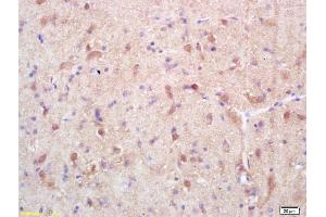 Formalin-fixed and paraffin embedded rat brain labeled with Rabbit Anti Exportin 1/CRM1 Polyclonal Antibody, Unconjugated (ABIN1714155) at 1:200 followed by conjugation to the secondary antibody and DAB staining (XPO1 antibody  (AA 701-800))