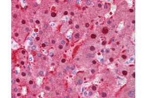 FAH antibody was used for immunohistochemistry at a concentration of 4-8 ug/ml. (FAH antibody)