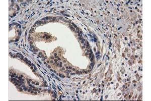 Image no. 14 for anti-Destrin (Actin Depolymerizing Factor) (DSTN) antibody (ABIN1497910) (Destrin antibody)