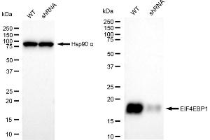 Western blotting analysis using EIF4EBP1 antibody (ABIN7798532).