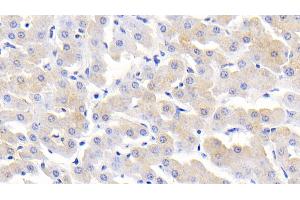 Detection of MCP2 in Bovine Liver Tissue using Polyclonal Antibody to Monocyte Chemotactic Protein 2 (MCP2) (CCL8 antibody  (AA 1-99))