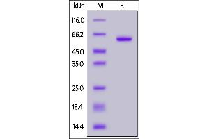 SARS-CoV-2 S protein RBD (K417N, E484K, N501Y), Fc Tag on  under reducing (R) condition. (SARS-CoV-2 Spike Protein (B.1.351 - beta, RBD) (Fc Tag))