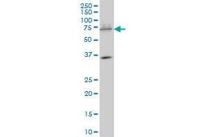 SMARCD3 monoclonal antibody (M01), clone 1G6 Western Blot analysis of SMARCD3 expression in K-562 . (SMARCD3 antibody  (AA 385-483))