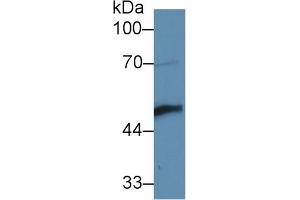 Detection of LYAR in Human A431 cell lysate using Polyclonal Antibody to Ly1 Antibody Reactive Homolog (LYAR) (LYAR antibody  (AA 270-388))