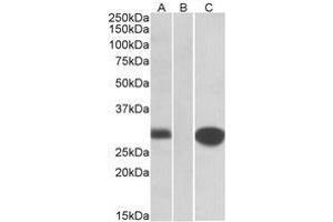 HEK293 lysate (10ug protein in RIPA buffer) overexpressing Human MID1IP1 with C-terminal MYC tag probed with AP22415PU-N (1 µg/ml) in Lane A and probed with anti-MYC Tag (1/1000) in lane C.