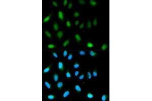 Immunofluorescence analysis of HeLa cells using CBX5 antibody. (CBX5 antibody  (AA 1-191))