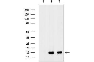 anti-Ribosomal Protein L34 (RPL34) (C-Term) antibody