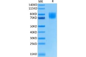 Biotinylated Human FGFR1 alpha (IIIc) on Tris-Bis PAGE under reduced condition. (FGFR-1 Alpha(IIIc) (AA 22-374) protein (His-Avi Tag,Biotin))