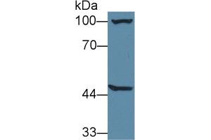 Western Blot; Sample: Mouse Liver lysate; Primary Ab: 1µg/ml Rabbit Anti-Mouse AGXT2 Antibody Second Ab: 0. (AGXT2 antibody  (AA 226-513))