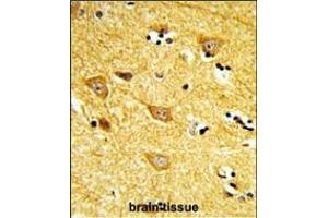 Formalin-fixed and paraffin-embedded human brain tissue reacted with INB Antibody (Center), which was peroxidase-conjugated to the secondary antibody, followed by DAB staining. (INPP4B antibody  (AA 367-393))