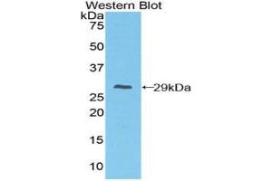 Western blot analysis of recombinant Mouse FcgRI. (FCGR1 antibody  (AA 73-294))