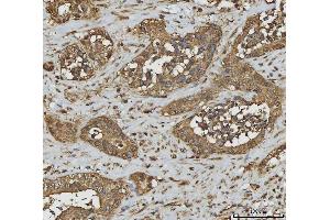 IHC analysis of Annexin A10/ANXA10 using anti-Annexin A10/ANXA10 antibody (ABIN7601853).