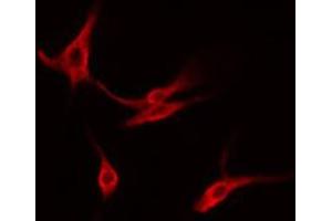 ABIN6274565 staining Hela cells by IF/ICC. (14-3-3 gamma antibody  (Internal Region))