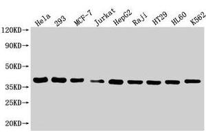 Western Blotting (WB) image for anti-HtrA Serine Peptidase 2 (HTRA2) (AA 334-458) antibody (ABIN7168921)
