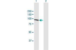 Western Blotting (WB) image for anti-Procollagen-Lysine 2-Oxoglutarate 5-Dioxygenase 2 (PLOD2) (AA 1-758) antibody (ABIN950032)