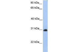 WB Suggested Anti-CHST14 Antibody Titration:  0. (CHST14 antibody  (Middle Region))