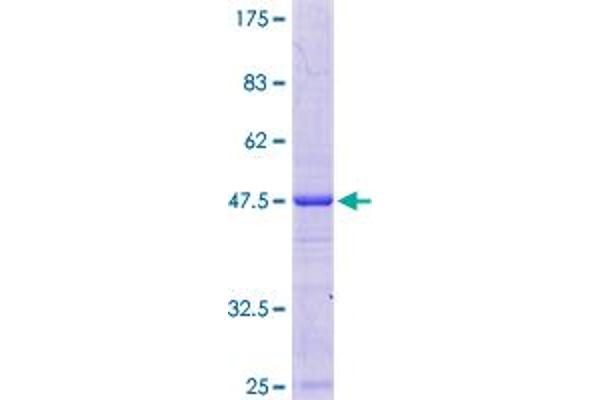 LSMD1 Protein (AA 1-173) (GST tag)