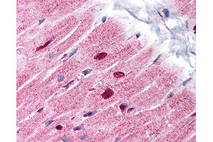 Anti-ANP32A antibody IHC of human heart. (PHAP1 antibody  (C-Term))