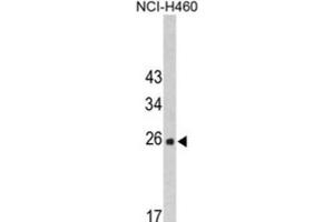 Western Blotting (WB) image for anti-FK506 Binding Protein 14, 22 KDa (FKBP14) antibody (ABIN3002691) (FKBP14 antibody)