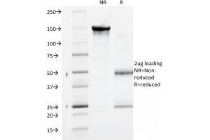 SDS-PAGE Analysis Purified Catenin, gamma Mouse Monoclonal Antibody (CTNG/1664). (JUP antibody)