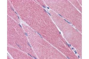 IHC testing of FFPE human skeletal muscle tissue with CREB3L1 antibody at 3. (CREB3L1 antibody)