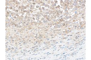 Immunohistochemistry (IHC) image for anti-DEAD (Asp-Glu-Ala-Asp) Box Polypeptide 3, X-Linked (DDX3X) (AA 1-50) antibody (ABIN7454637)