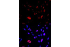 Immunofluorescence analysis of U2OS cells using HUS1 antibody (ABIN5973136). (HUS1 antibody)