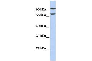 FAM38B antibody used at 1 ug/ml to detect target protein. (PIEZO2 antibody  (Middle Region))