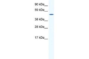 SP1 antibody (20R-1138) used at 0. (SP1 antibody  (Middle Region))