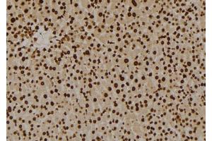 ABIN6258929 and ABIN6276023 at 1/100 staining Mouse liver tissue by IHC-P.