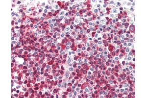 Anti-DKC1 antibody IHC of human spleen. (DKC1 antibody  (AA 446-460))