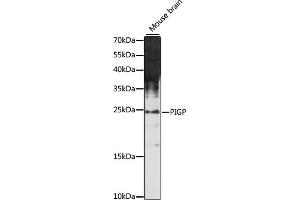 Western blot analysis of extracts of mouse brain, using PIGP antibody (ABIN7269289) at 1:1000 dilution. (PIGP antibody  (AA 25-158))