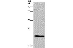 Western blot analysis of Mouse heart tissue, using CMTM5 Polyclonal Antibody at dilution of 1:400