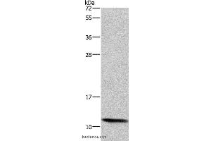 Western blot analysis of HepG2 cell, using HSPE1 Polyclonal Antibody at dilution of 1:750 (HSPE1 antibody)