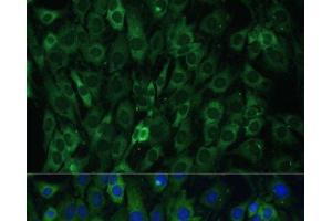 Immunofluorescence analysis of C6 cells using EIF3D Polyclonal Antibody at dilution of 1:100. (EIF3D antibody)