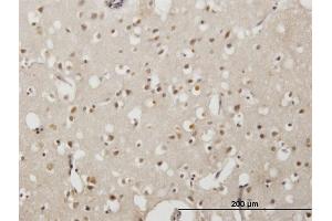 Immunoperoxidase of monoclonal antibody to EMX2 on formalin-fixed paraffin-embedded human cerebral cortex. (EMX2 antibody  (AA 103-200))