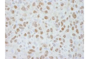 Immunohistochemistry (IHC) image for anti-Damage Specific DNA Binding Protein 1 (DDB1) (C-Term) antibody (ABIN7448511) (DDB1 antibody  (C-Term))