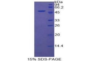 SDS-PAGE (SDS) image for Coagulation Factor V (F5) (AA 1894-2047) protein (His tag,GST tag) (ABIN2122658) (Coagulation Factor V Protein (F5) (AA 1894-2047) (His tag,GST tag))