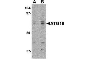 Western blot analysis of ATG16 in HeLa cell lysate with ATG16 antibody at (A) 0. (ATG16L1 antibody  (Center))