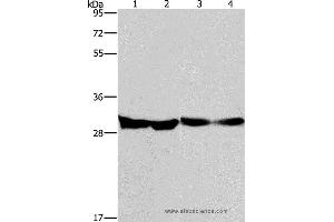 Western blot analysis of Human endometrial carcinoma and colon cancer tissue, mouse heart tissue and PC3 cell, using DECR1 Polyclonal Antibody at dilution of 1:300 (DECR1 antibody)