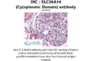 Image no. 1 for anti-Solute Carrier Family 39 (Zinc Transporter), Member 14 (SLC39A14) (Cytoplasmic Domain) antibody (ABIN1739369) (SLC39A14 antibody  (Cytoplasmic Domain))